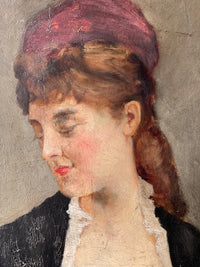 The cap showing the vertical line of loss running down into the hair and the shorter line beside it